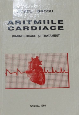 Aritmiile cardiace