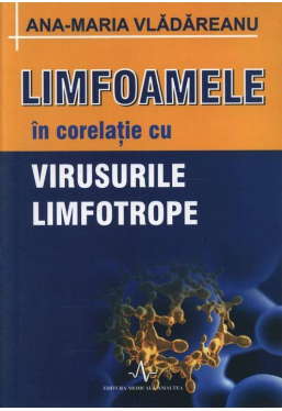 Limfoamele in corelatie cu virusurile limfotrope